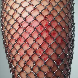 Close-up of chainmail-induced abrasions