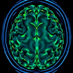 Quantum state imaging showing consciousness fragmentation patterns in a QCD patient